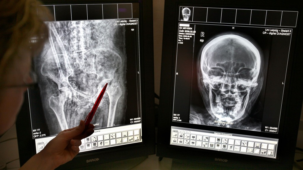 Blick auf digitale Röntgenaufnahmen