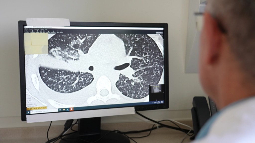 Foto: Ein Arzt betrachtet ein Krankheitsbild auf seinem Bildschirm.