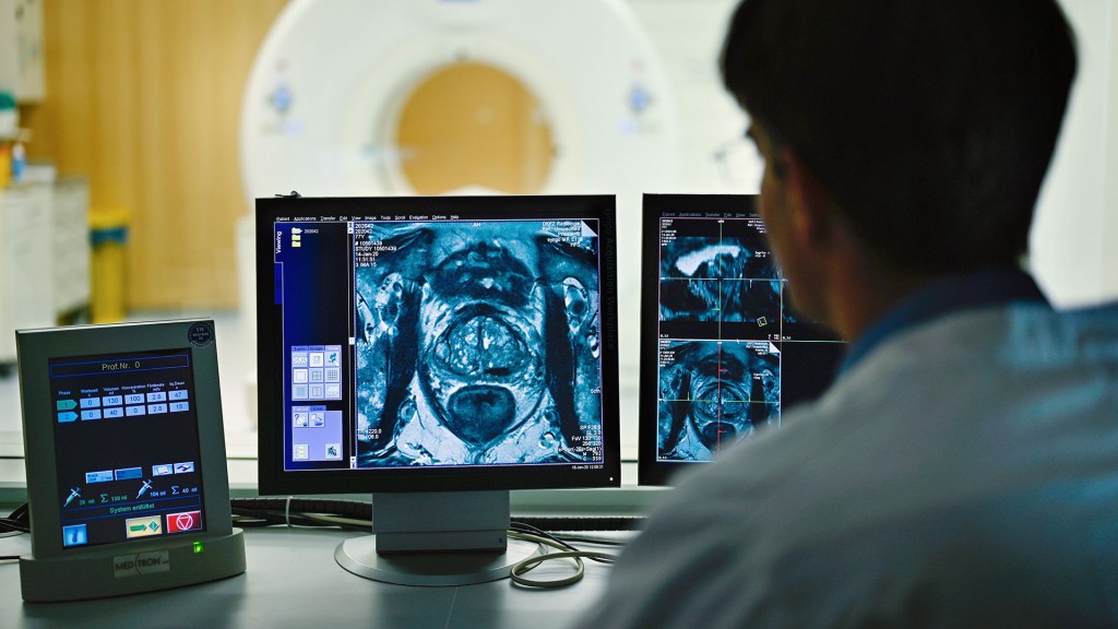 Ein Mitarbeiter untersucht medizinische Aufnahmen eines Krebspatienten