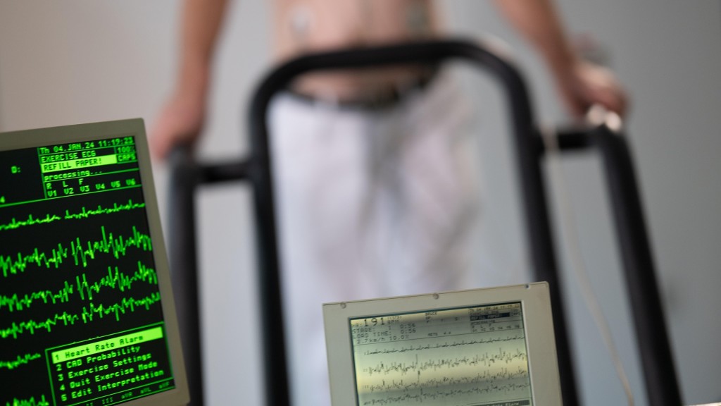 Mann beim Belastungs-EKG auf einem Laufband