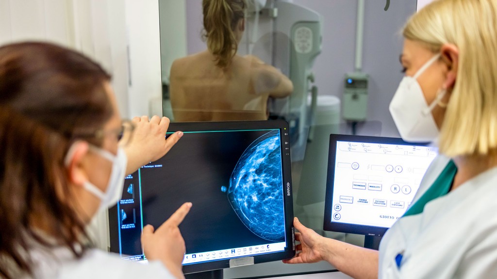Medizinisches Personal untersucht mit einer Mammografie die Brust einer Frau