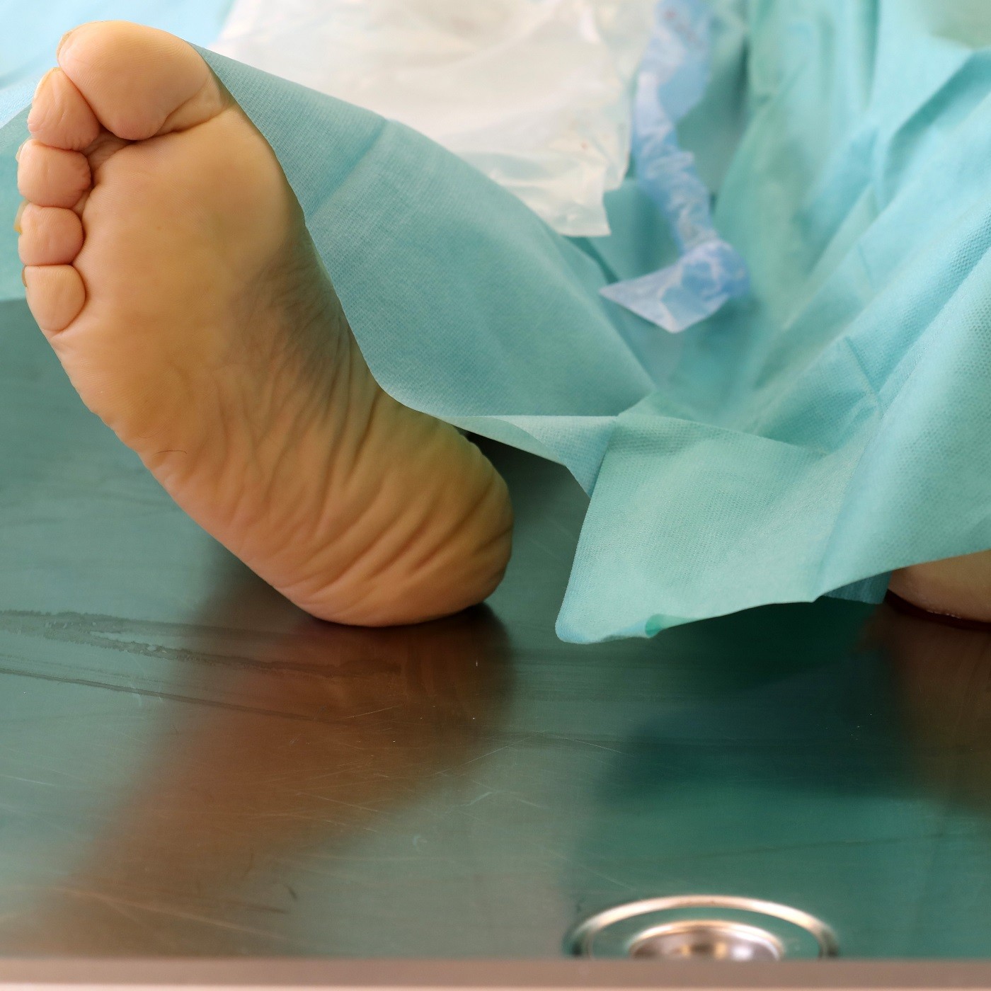 Todesursache unnatürlich?